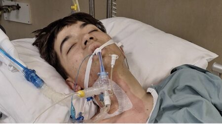 Watch: How Teen’s Inspiring Spirit Shines After Losing Leg in Tragic Accident
